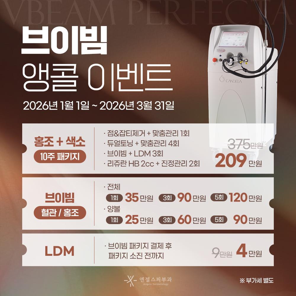 브이빔 앵콜 이벤트